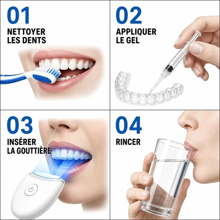 Étapes d'utilisation d'un kit blanchiment dentaire à domicile